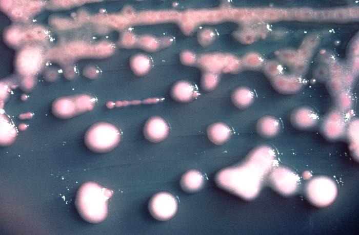 Klebsiella pneumoniae bacteria.